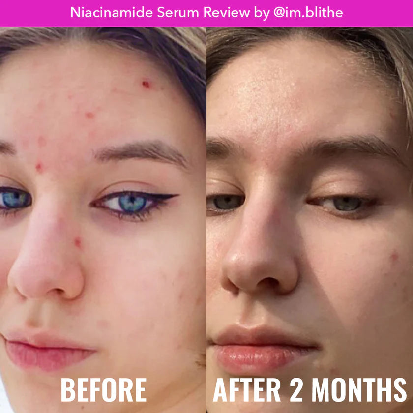 Suero Niacinamide Serum - Good Molecules