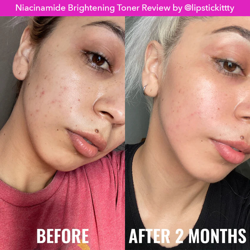 Tónico Niacinamide Brightening Toner - Good Molecules